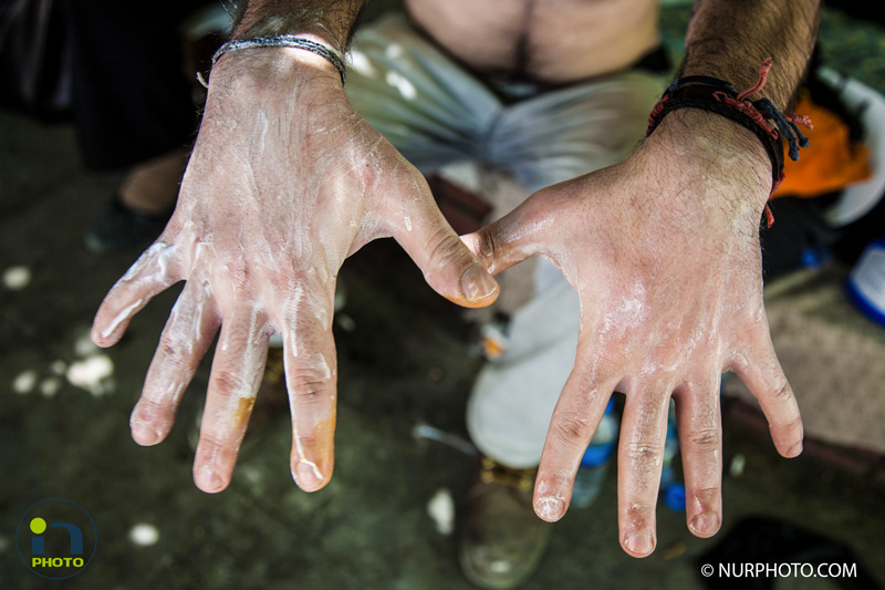 A man says his hands were burned by the gas police used against protesters. "It wasn't pepper gas," he insisted. Fights broke out when police came to Taksim Square on June 11, 2013, the 11th day of anti-government protests at Gezi Park. Photo: Jodi Hilton/NurPhoto